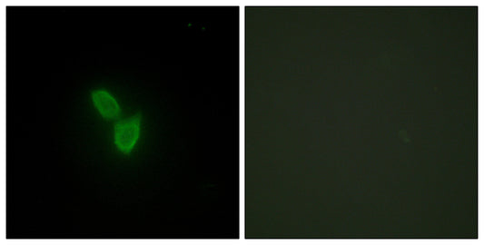 PARD3A Rabbit Polyclonal Antibody
