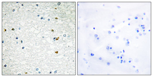 PARP-3 Rabbit Polyclonal Antibody