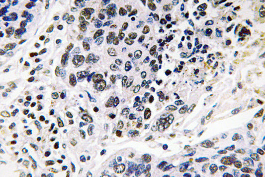 Pax-8 Rabbit Polyclonal Antibody