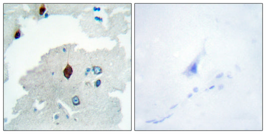 PBF Rabbit Polyclonal Antibody