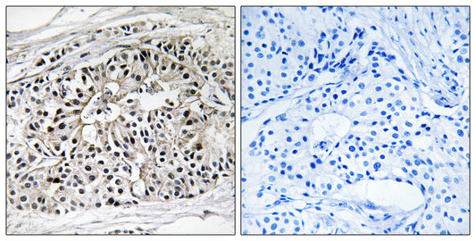 PBFE Rabbit Polyclonal Antibody