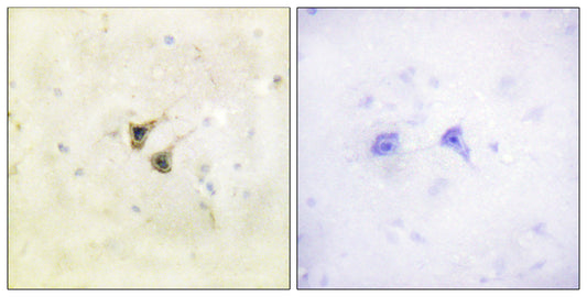 PBK Rabbit Polyclonal Antibody