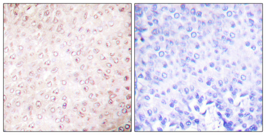 PCAF Rabbit Polyclonal Antibody