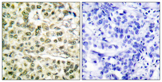 PCNA Rabbit Polyclonal Antibody