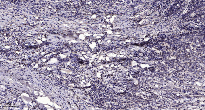 PCNT Rabbit Polyclonal Antibody