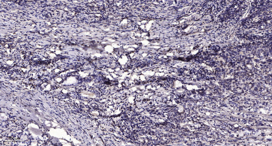 PCNT Rabbit Polyclonal Antibody
