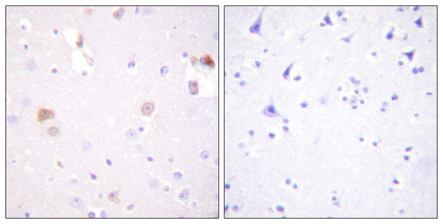 PC-PLD1 Rabbit Polyclonal Antibody