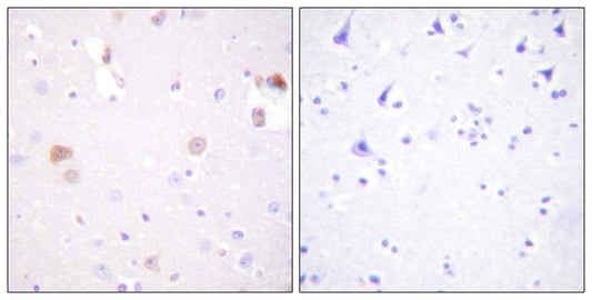 PC-PLD1 Rabbit Polyclonal Antibody