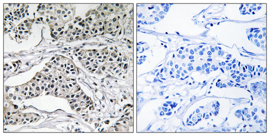 PC-PLD3 Rabbit Polyclonal Antibody
