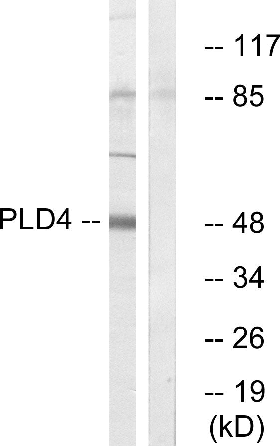 PC-PLD4 Rabbit Polyclonal Antibody