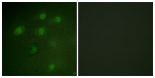 Pdcd-4 Rabbit Polyclonal Antibody