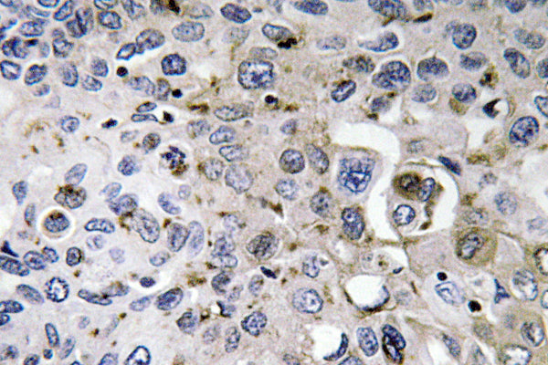 PDGF-A Rabbit Polyclonal Antibody