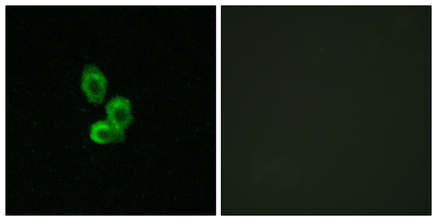 PDGFR-β Rabbit Polyclonal Antibody