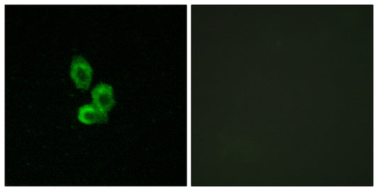 PDGFR-β Rabbit Polyclonal Antibody