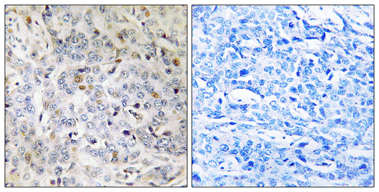 PDIK1L Rabbit Polyclonal Antibody