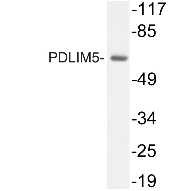 PDLIM5 Rabbit Polyclonal Antibody
