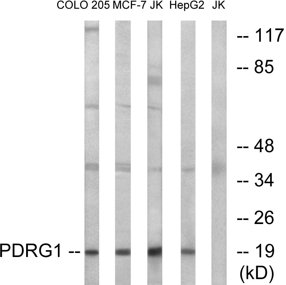 PDRG1 Rabbit Polyclonal Antibody