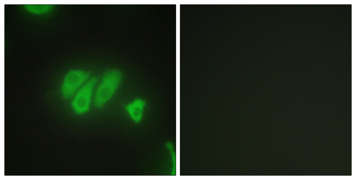 PDZK3 Rabbit Polyclonal Antibody