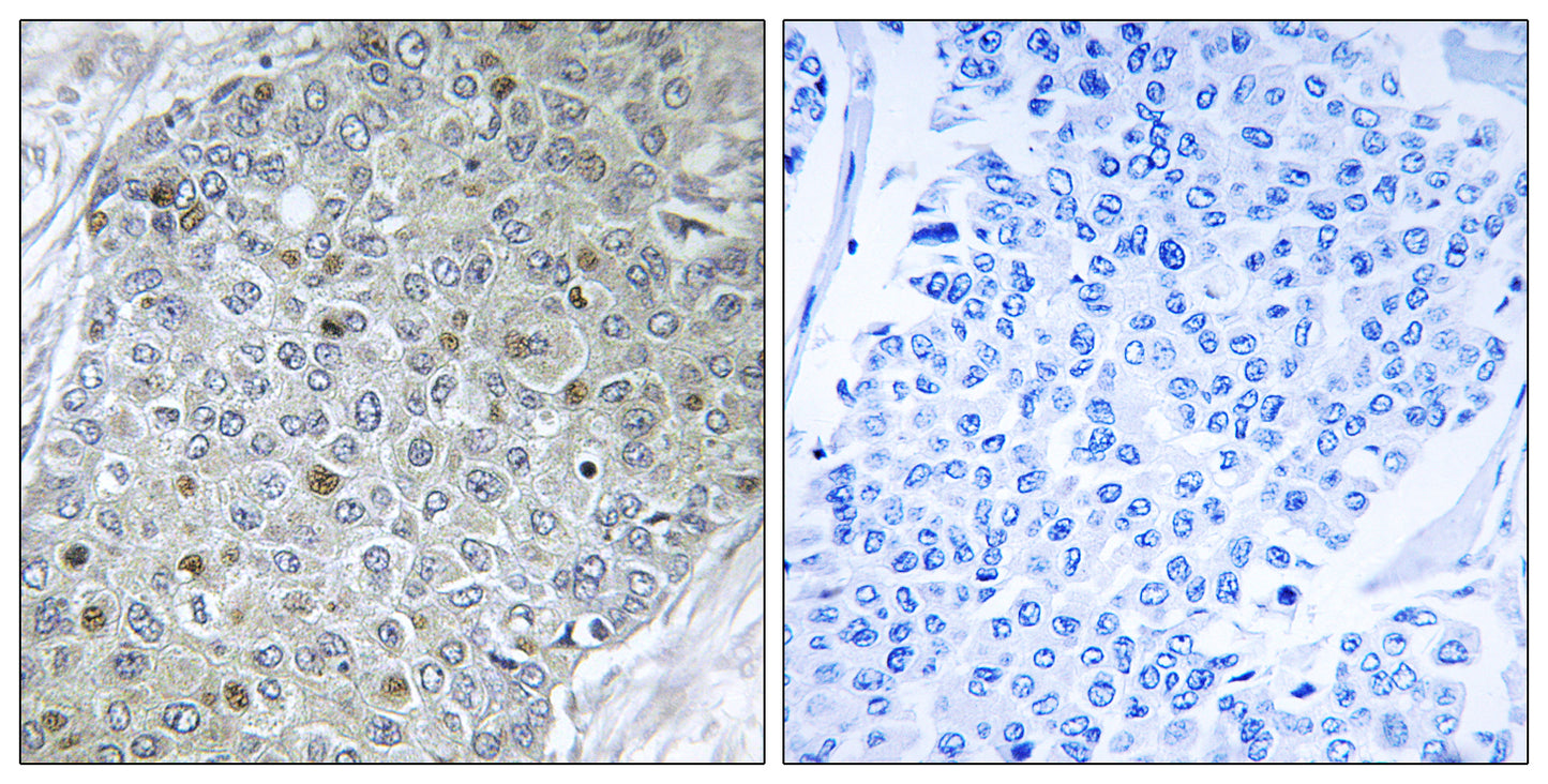 PEA3 Rabbit Polyclonal Antibody