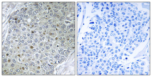 PEA3 Rabbit Polyclonal Antibody