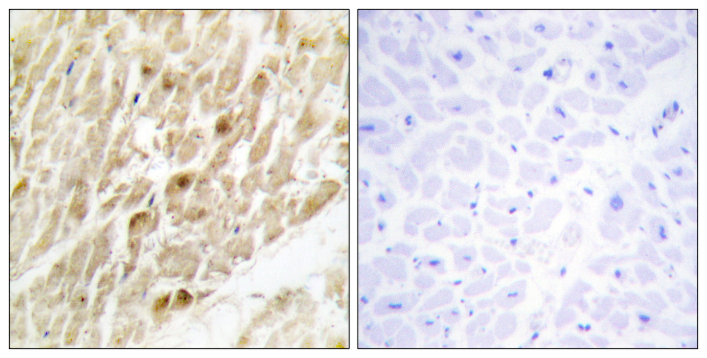 PEBP2β Rabbit Polyclonal Antibody