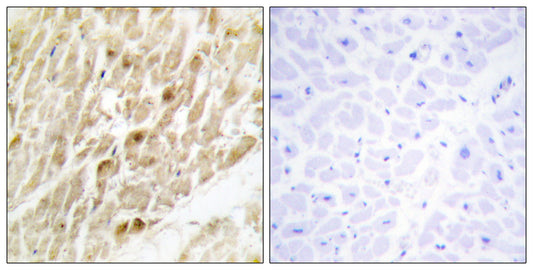 PEBP2β Rabbit Polyclonal Antibody