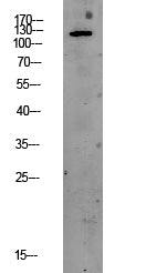 PEK/PERK Rabbit Polyclonal Antibody