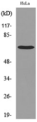 PEPCK-C Rabbit Polyclonal Antibody