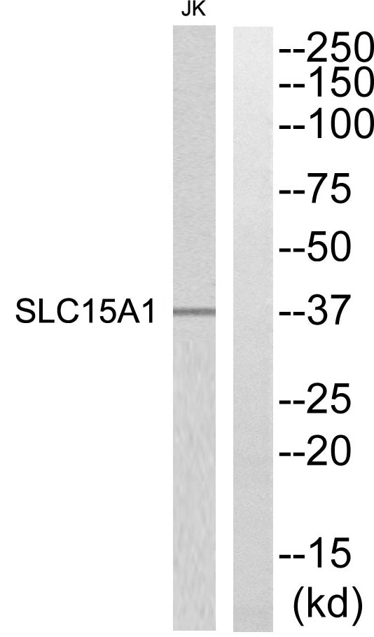 PEPT1 Rabbit Polyclonal Antibody