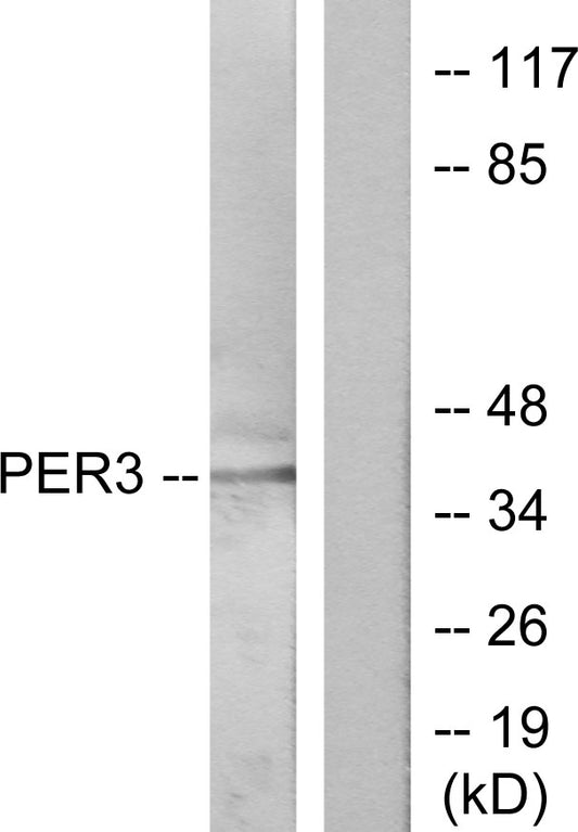 Per3 Rabbit Polyclonal Antibody