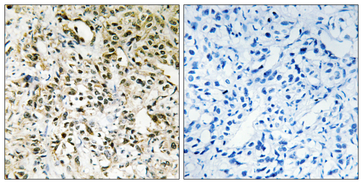 Periphilin 1 Rabbit Polyclonal Antibody