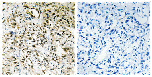 Periphilin 1 Rabbit Polyclonal Antibody