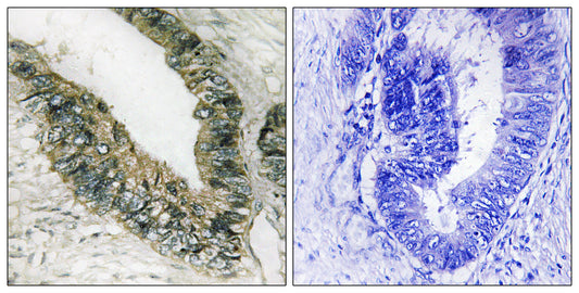 PERK Rabbit Polyclonal Antibody