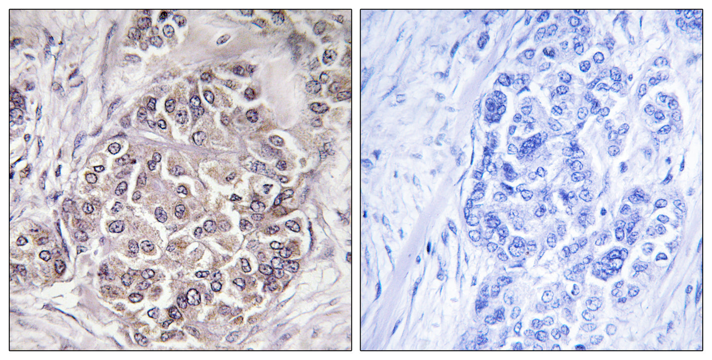 Peroxin 1 Rabbit Polyclonal Antibody