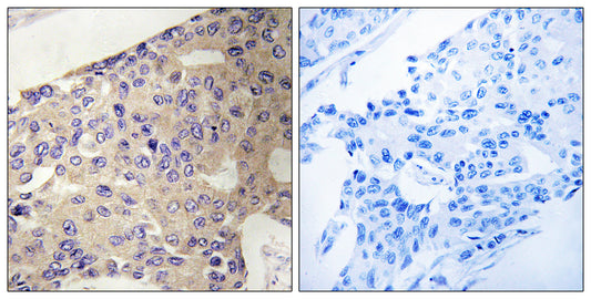 Peroxin 10 Rabbit Polyclonal Antibody