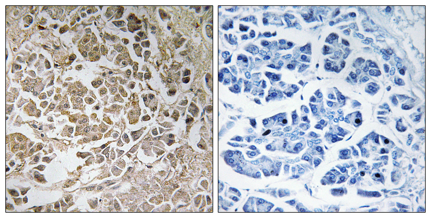 Peroxin 11γ Rabbit Polyclonal Antibody