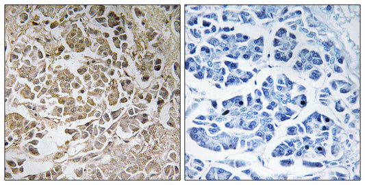 Peroxin 11γ Rabbit Polyclonal Antibody