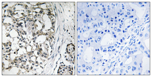 Peroxin 14 Rabbit Polyclonal Antibody