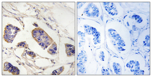 Peroxin 7 Rabbit Polyclonal Antibody