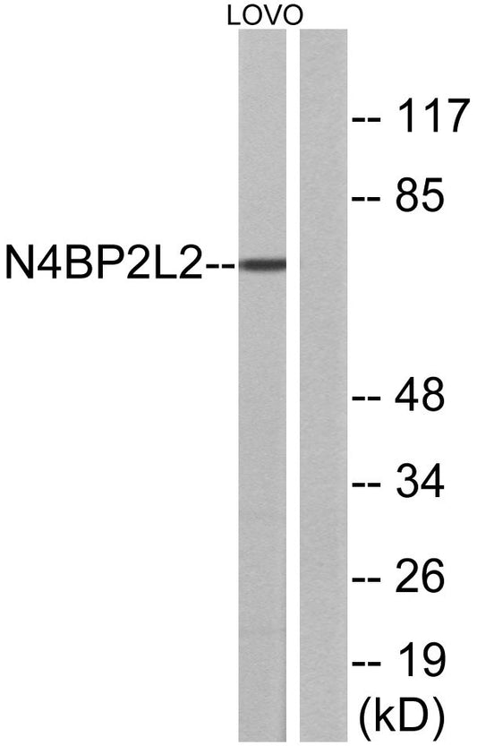 PFAAP5 Rabbit Polyclonal Antibody