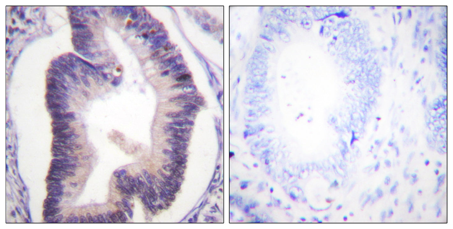 PFK-2 car Rabbit Polyclonal Antibody