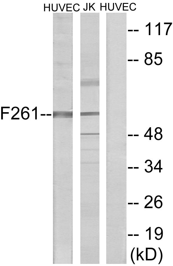 PFK-2 liv Rabbit Polyclonal Antibody
