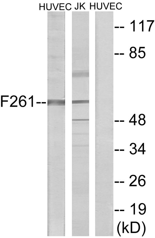 PFK-2 liv Rabbit Polyclonal Antibody