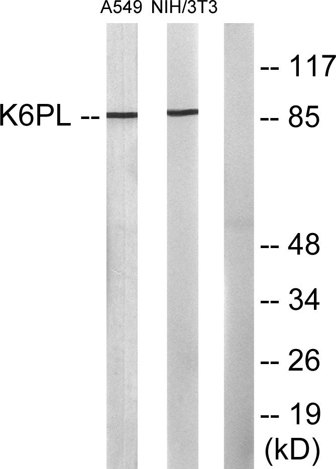 PFK-B Rabbit Polyclonal Antibody