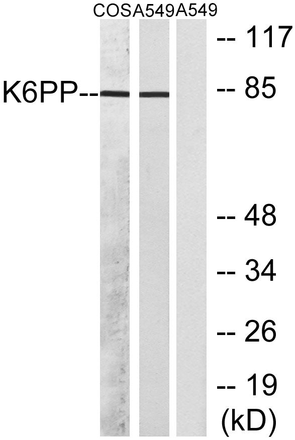 PFK-C Rabbit Polyclonal Antibody
