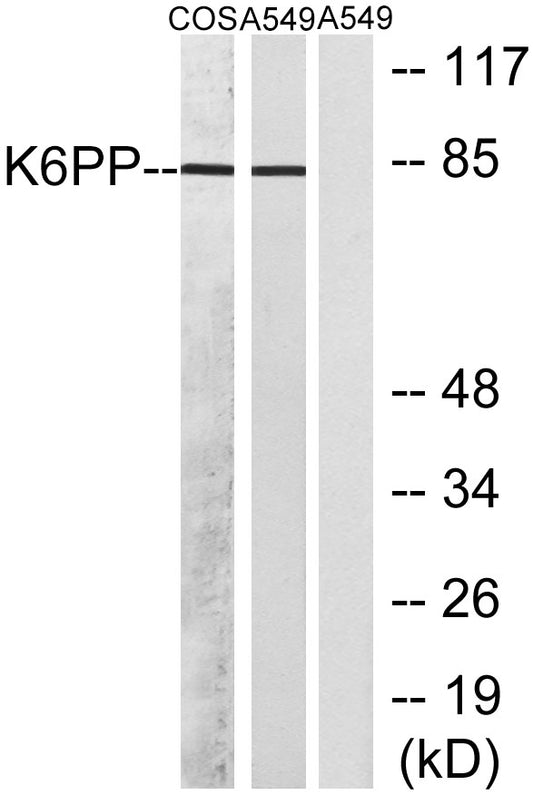 PFK-C Rabbit Polyclonal Antibody