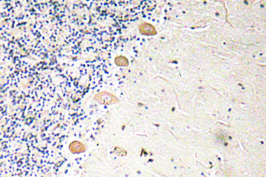 PFKM Rabbit Polyclonal Antibody