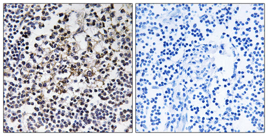 PGLS Rabbit Polyclonal Antibody