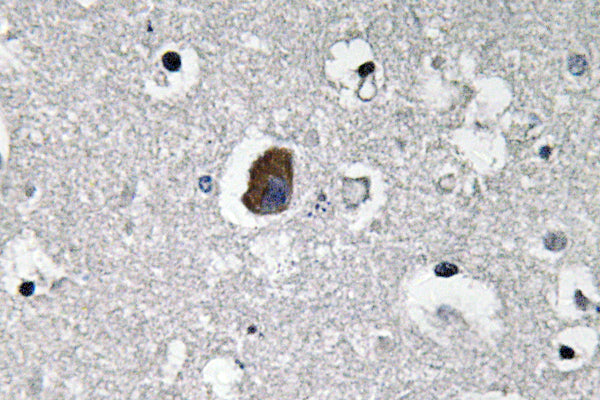P-glycoprotein 1 Rabbit Polyclonal Antibody