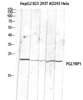 PGLYRP1 Rabbit Polyclonal Antibody